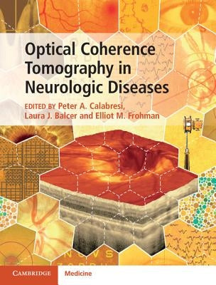 Optical Coherence Tomography in Neurologic Diseases by Calabresi, Peter A.