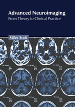 Advanced Neuroimaging: From Theory to Clinical Practice by Scott, Miles