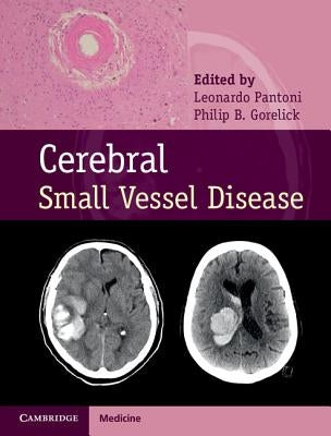 Cerebral Small Vessel Disease by Pantoni, Leonardo