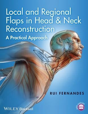 Local and Regional Flaps in Head and Neck Reconstruction: A Practical Approach by Fernandes, Rui