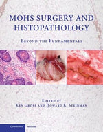 Mohs Surgery and Histopathology: Beyond the Fundamentals by Gross, Ken