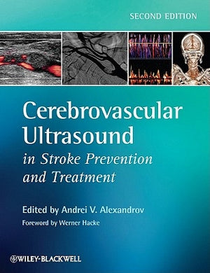 Cerebrovascular Ultrasound in Stroke Prevention and Treatment by Alexandrov, Andrei V.