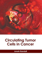 Circulating Tumor Cells in Cancer by Randall, Jonah