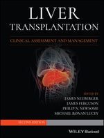 Liver Transplantation by Neuberger, James