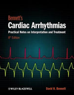 Cardiac Arrhythmias 8e by Bennett, David H.