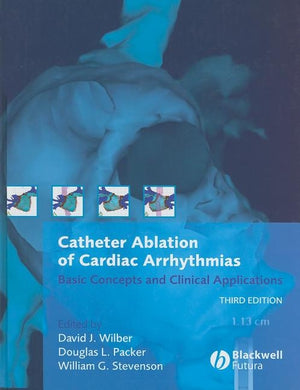 Catheter Ablation of Cardiac Arrhythmias by Wilber, David J.