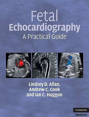 Fetal Echocardiography: A Practical Guide [With DVD] by Allan, Lindsey D.