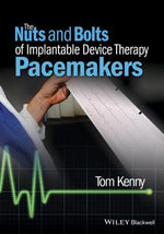 The Nuts and Bolts of Implantable Device Therapy: Pacemakers by Kenny, Tom