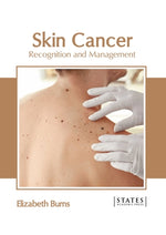 Skin Cancer: Recognition and Management by Burns, Elizabeth