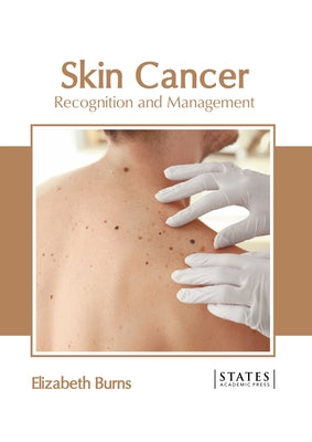 Skin Cancer: Recognition and Management by Burns, Elizabeth